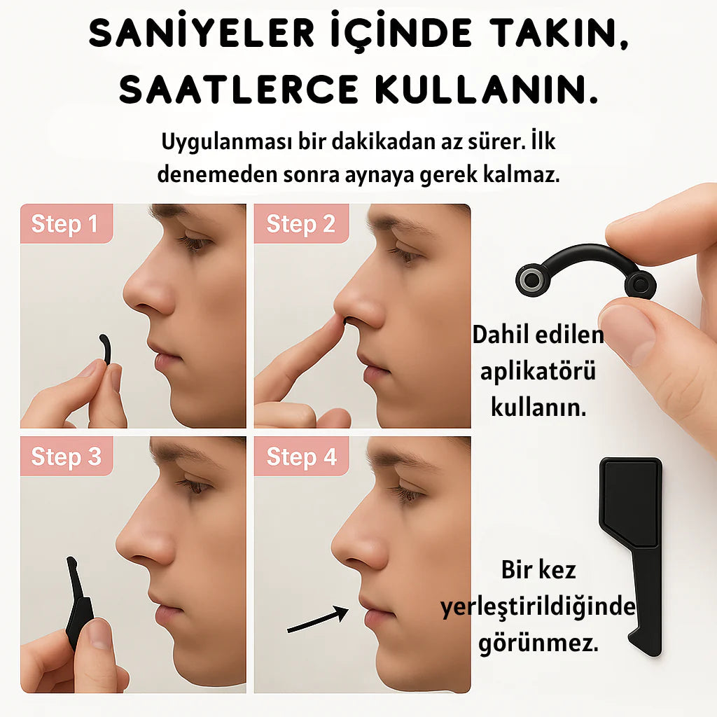 Burunest™ Noselift